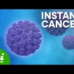 Only 5 infections responsible for more than 2 million new cases of cancer per year: ScienceAlert