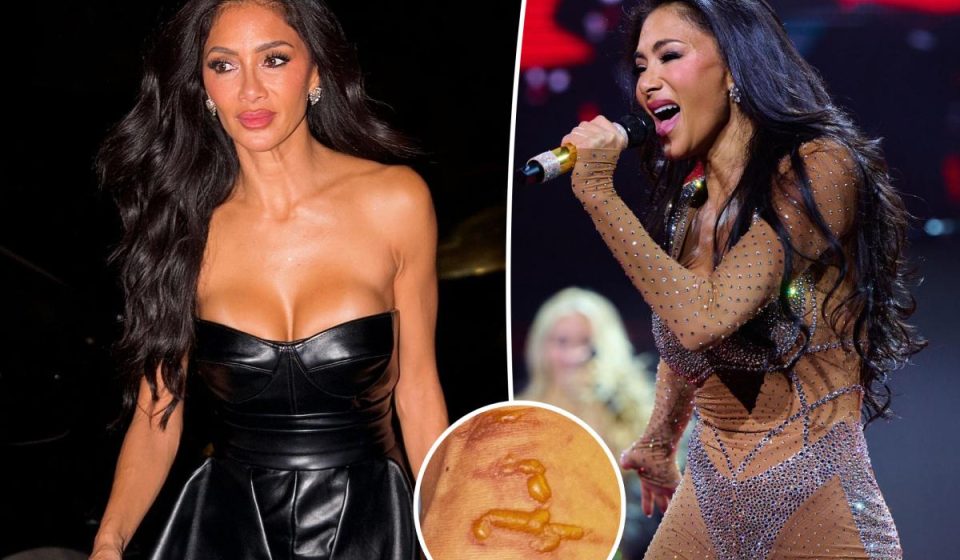 Nicole Scherzinger shows horrific injury after boiling water falls on her leg 1 hour before concert