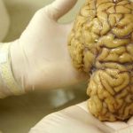 Scientists map gene activity in the brain's prefrontal cortex
