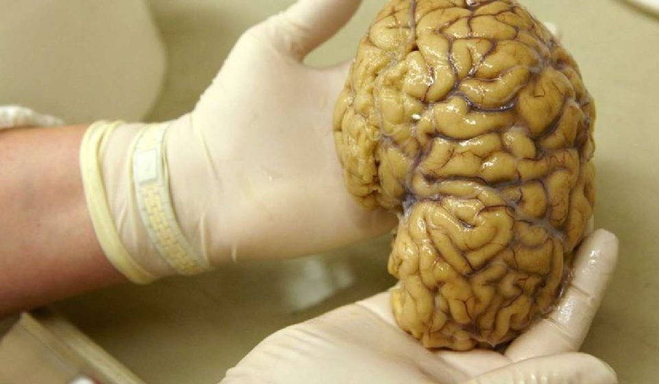 Scientists map gene activity in the brain's prefrontal cortex