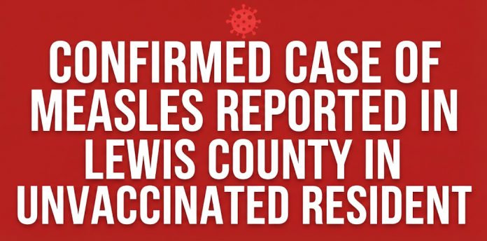 Confirmed case of measles reported in Lewis County in unvaccinated resident