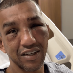 Raoni Barcelos shares video from hospital bed, vows to 'come back stronger' after terrifying UFC Vegas 121 loss
