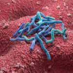 1 in 8 cancers are caused by infections. The biggest culprit is not HPV