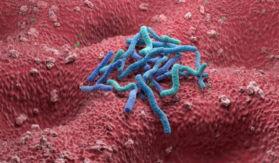 1 in 8 cancers are caused by infections. The biggest culprit is not HPV