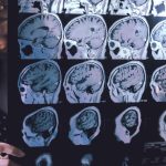 One family's struggle with early-onset dementia could lead to a cure