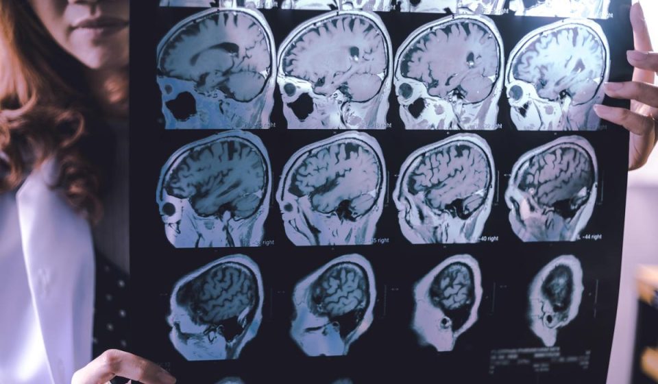One family's struggle with early-onset dementia could lead to a cure