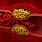 “52.5% less bad cholesterol”: a treatment that doctors did not see coming