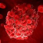 The thrombotic risks of MHT differ depending on the route, dose and duration