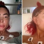 Farrah Abraham looks unrecognizable after major jaw surgery, manager says she is in 'excruciating pain'