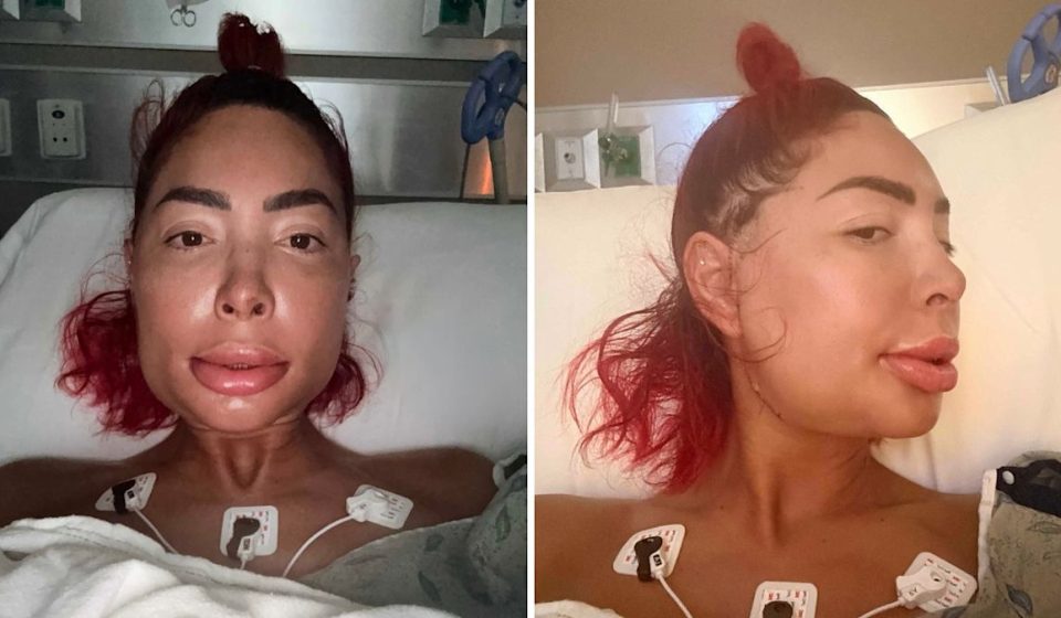 Farrah Abraham looks unrecognizable after major jaw surgery, manager says she is in 'excruciating pain'