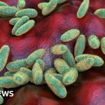 What is pneumonic plague and how is it spread? -BBC