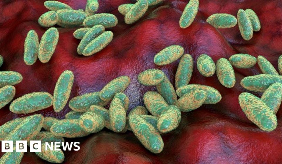 What is pneumonic plague and how is it spread? -BBC