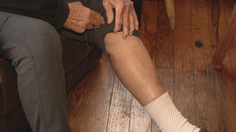 91-year-old man says he was attacked by a raccoon outside his Barrington home