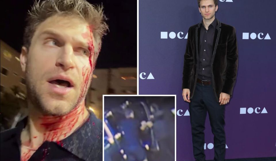 'Pretty Little Liars' star blasts Gavin Newsom and Karen Bass after robbery