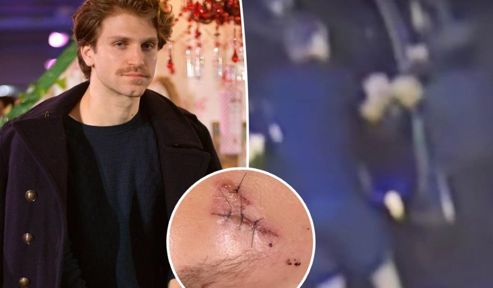 Pretty Little Liars Star Keegan Allen Reveals Stitches Following LA Armed Robbery