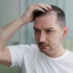Men who struggle with baldness may soon have a new pill to turn to
