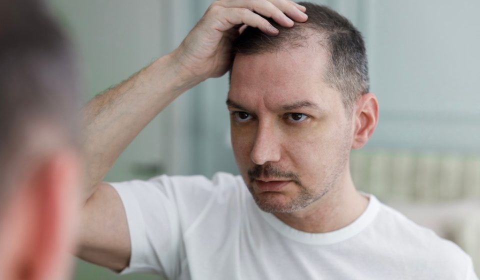 Men who struggle with baldness may soon have a new pill to turn to