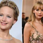 Jennifer Lawrence probably had multiple plastic surgery procedures costing $30,000 for a 'younger' look