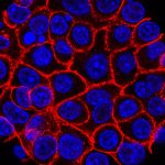 How a promising pancreatic cancer drug is losing its effectiveness