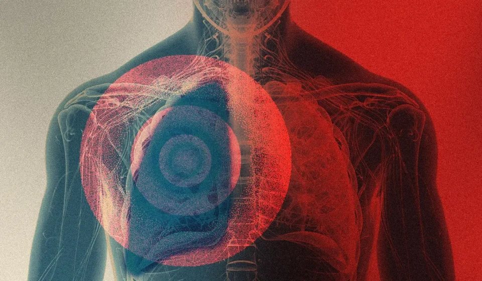 How Pneumonic Plague Spreads, and How It Does or Does Not Look Like COVID