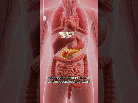 New pancreatic cancer vaccine triggered immune responses in 99% of patients: ScienceAlert New pancreatic cancer vaccine triggered immune responses in 99% of patients: ScienceAlert