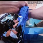 Austin man undergoes surgery 11 days after being shot by ICE agent