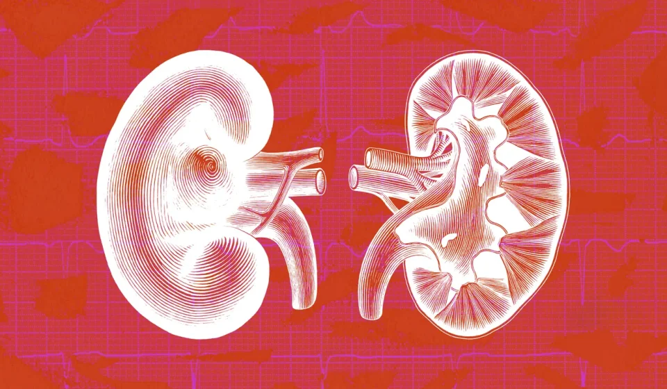 Exclusive: HHS releases new kidney care plan