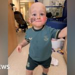 Wirral child gets 'second chance at life' after stem cell transplant - BBC News Africa