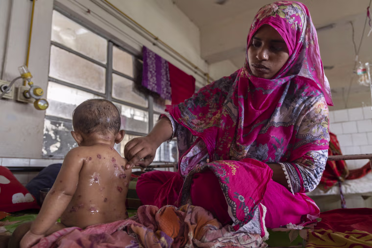 Bangladesh measles outbreak 'real warning' for other countries, experts say