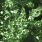 Pennsylvania reports fifth measles-related death in state