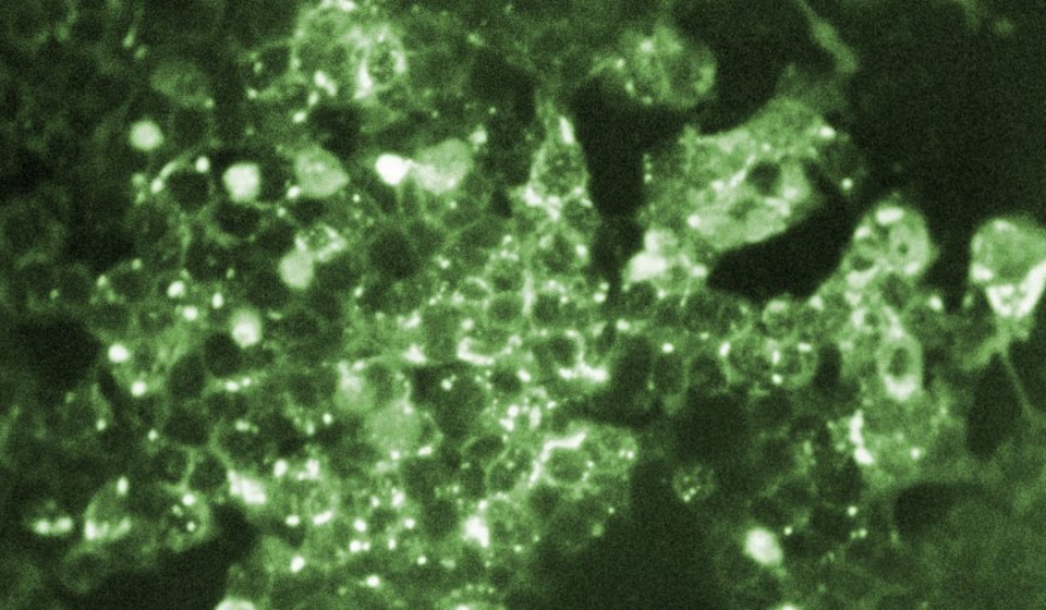 Pennsylvania reports fifth measles-related death in state