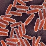 What is pneumonic plague? What you need to know after a woman's mysterious death in Russia