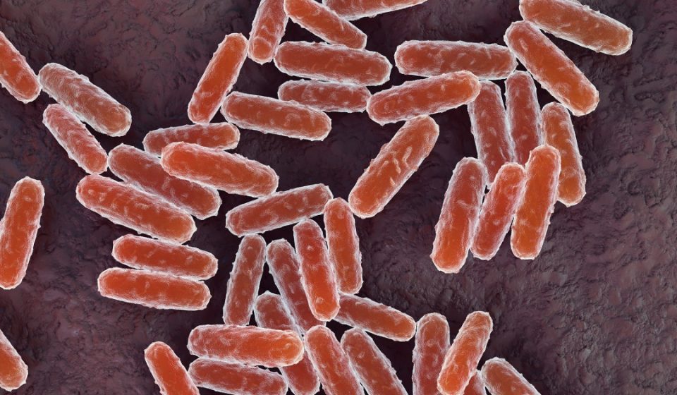 What is pneumonic plague? What you need to know after a woman’s mysterious death in Russia What is pneumonic plague? What you need to know after a woman's mysterious death in Russia
