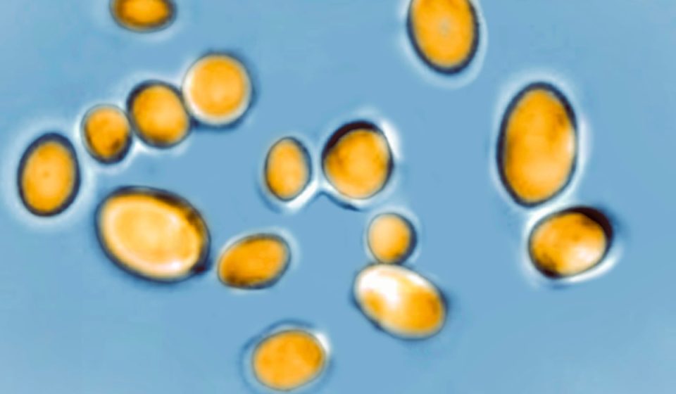 CDC warns of threat of drug-resistant germs, which kill 50,000 people a year