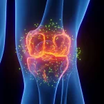 FDA-approved epilepsy drug may help reverse osteoarthritis damage