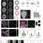 Osteoclasts intercept meningeal lymphatic pathways for dural metastases