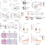 tRNA dosage regulates lineage dependence and resistance in prostate cancer