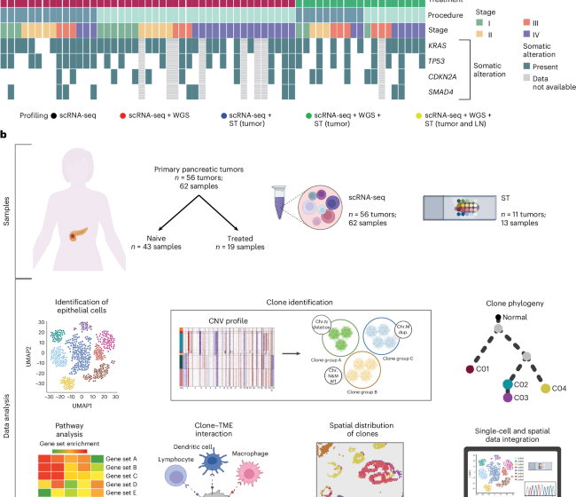 Clonal heterogeneity in human pancreatic ductal adenocarcinoma and its impact on tumor progression