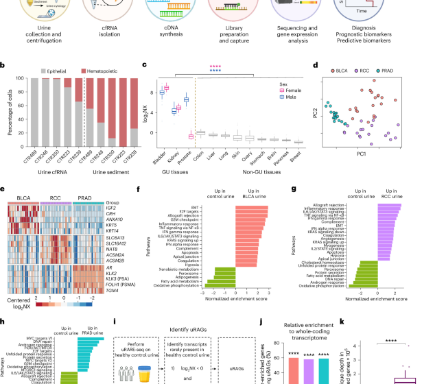 Cell-Free RNA in Urine for Bladder Cancer Detection and Prediction of Treatment Response