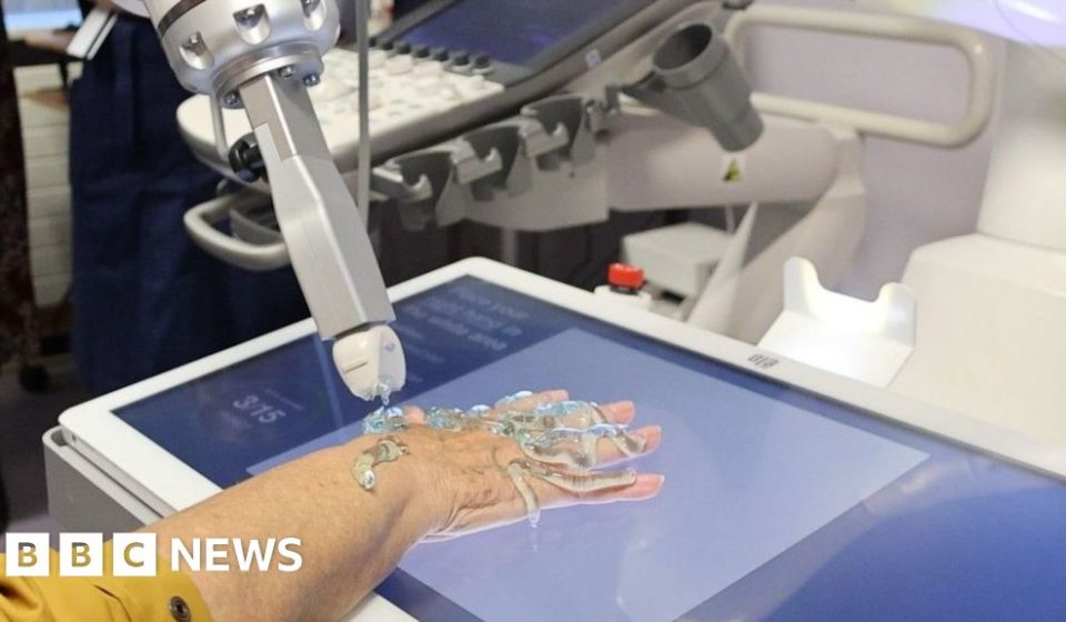 Arthur robot is a UK first for hand arthritis scans - BBC