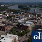 Ohio woman sues hospital for allegedly amputating wrong leg during surgery | Ohio