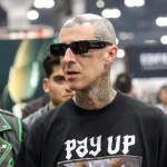 Travis Barker in hospital undergoes surgery for 'numb' arm