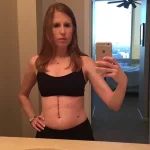 She thought it was food poisoning. It was liver cancer