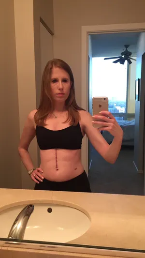 She thought it was food poisoning. It was liver cancer