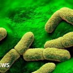 US 'closely monitoring' death of Russian plague researcher