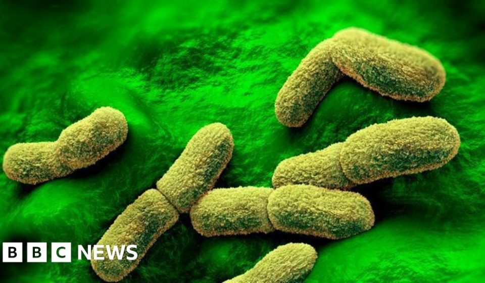US 'closely monitoring' death of Russian plague researcher