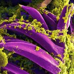 What is pneumonic plague and how will we know if it is spreading in Russia?