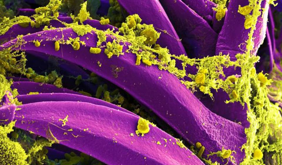 What is pneumonic plague and how will we know if it is spreading in Russia?