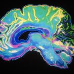 Psilocybin reshapes brain connections via distinct cellular pathways