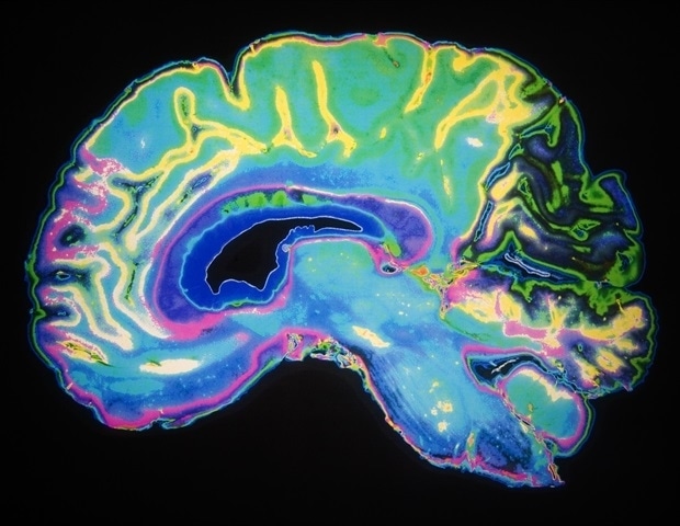 Psilocybin reshapes brain connections via distinct cellular pathways